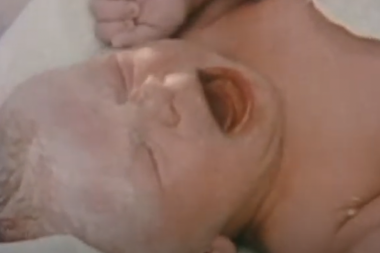 ONA JE PROMENILA TOK ISTORIJE U MEDICINI!  Rođena je kao "medicinsko čudo" i "uvreda za prirodu" koje je doktoru Robertu Edvardsu donela NOBELOVU NAGRADU! (VIDEO/FOTO)