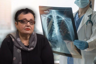 DR RADOSAVLJEVIĆ UPOZORAVA NA PRVI, PRIKRIVENI SIMPTOM RAKA PLUĆA: Jedna od najtežih bolesti kosi Srbe, a ovaj faktor rizika je ključan!