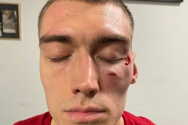 NANELI I LAZAREVIĆ IDU U POLICIJU: Evo kada će košarkaši opisati kako je Amerikanac udario Srbina u glavu