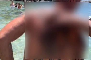 ŠOK I NEVERICA NA PLAŽI: Muškarac izašao iz mora, kad su videli šta mu je na LEĐIMA nastao je VRISAK! (VIDEO)