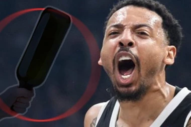 EKSKLUZIVNA FOTOGRAFIJA! Pogledajte kako izgleda čovek kog je Karlik unakazio (UZNEMIRUJUĆI SADRŽAJ)